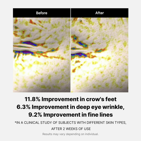 Puffiness Reduction