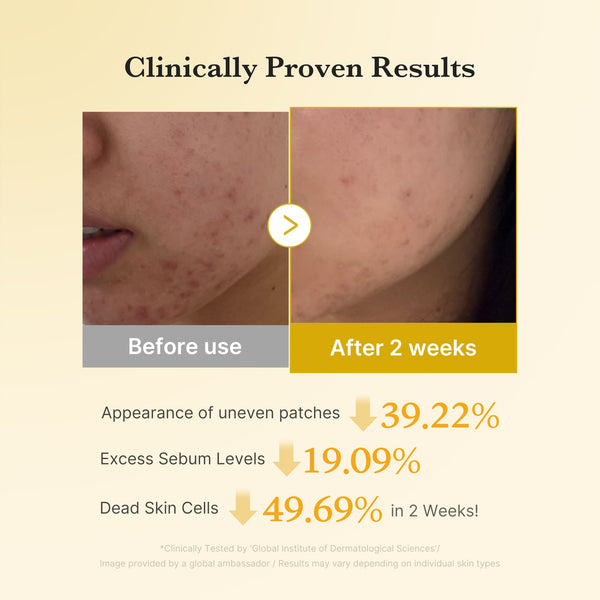 Daily Gentle Exfoliation