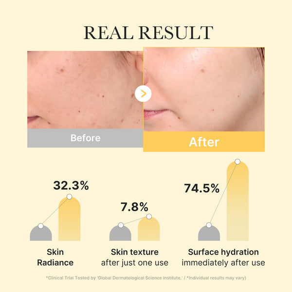 24K Gold Anti-Aging