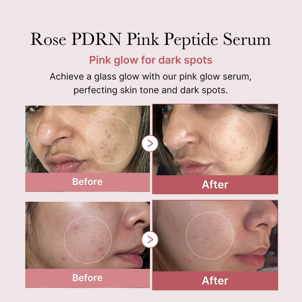Strengthens Skin Barrier