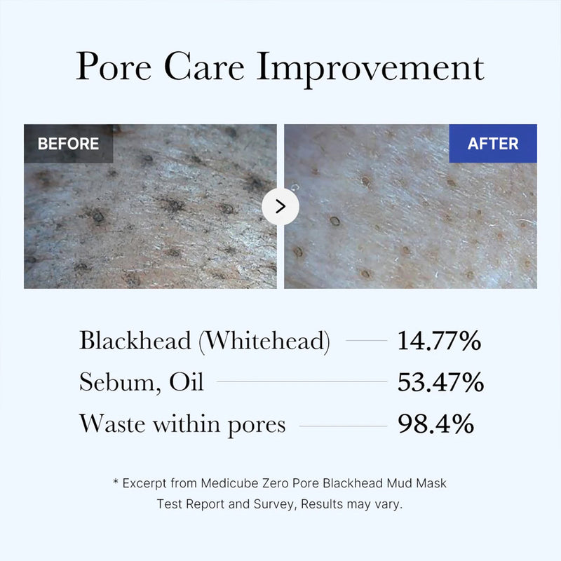 Deep Pore Cleansing for Visibly Blackhead-Free Skin
