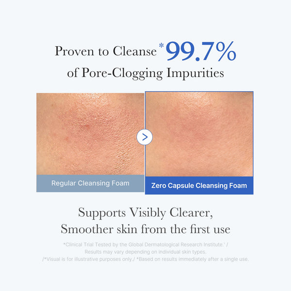 Gentle Multi-Acid Exfoliation