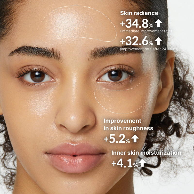 Visible Improvement in Post-Acne Marks