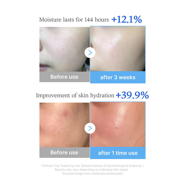 Intensive Soothing + Even Tone