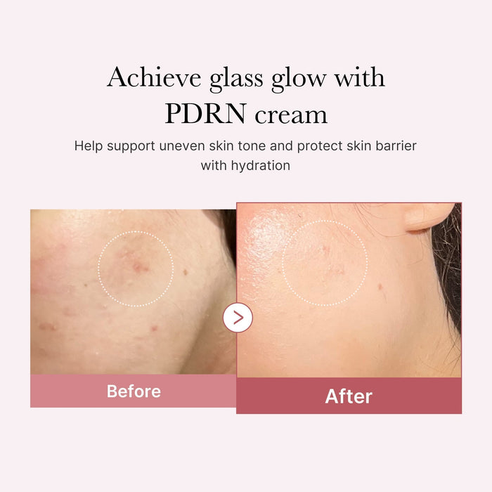 Hyaluronic Acid + Peptide Complex
