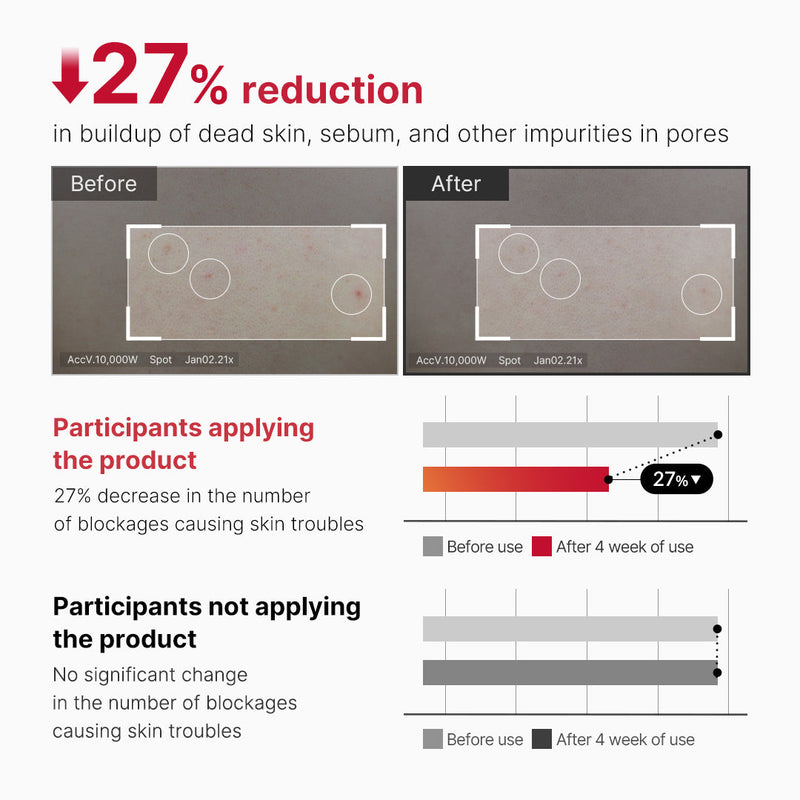 Targeted Peeling Care for Body Acne-Prone Skin